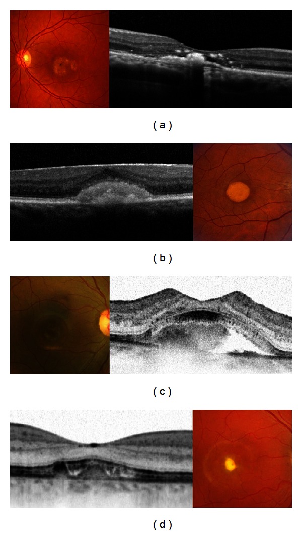 Figure 4