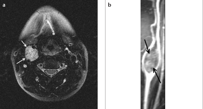 Figure 5. a, b.