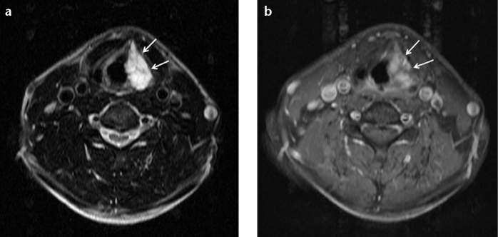 Figure 9. a, b.