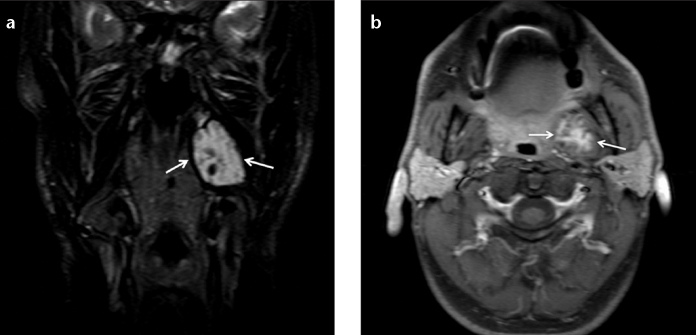 Figure 7. a, b.