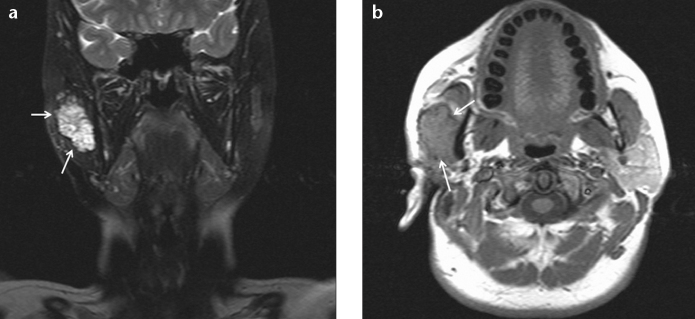 Figure 1. a, b.