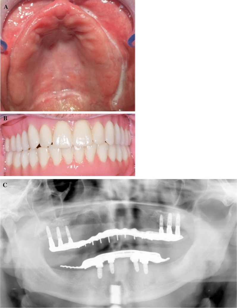 Fig. 5