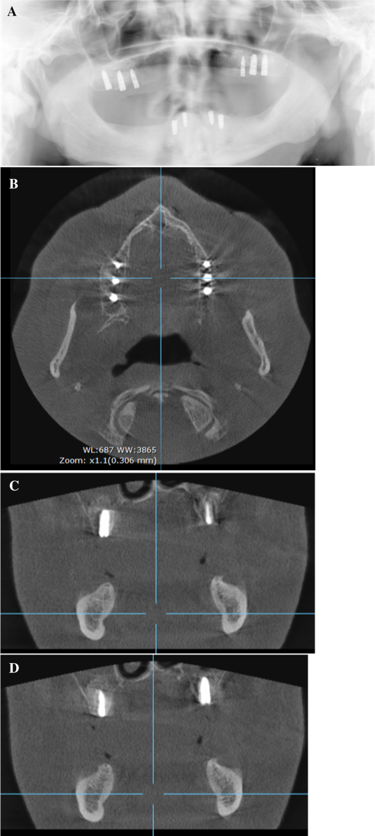 Fig. 3