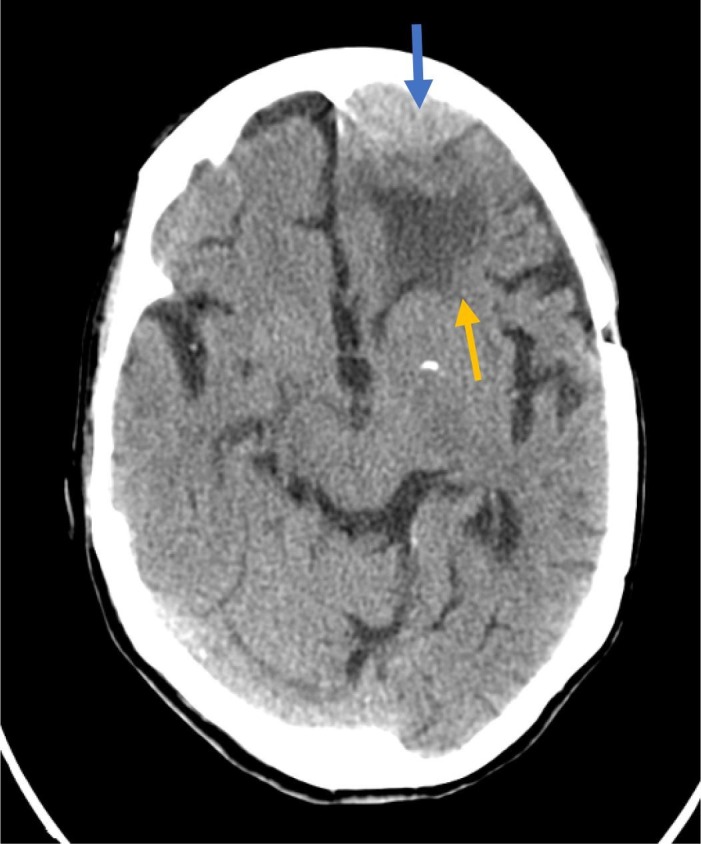 Fig. 2