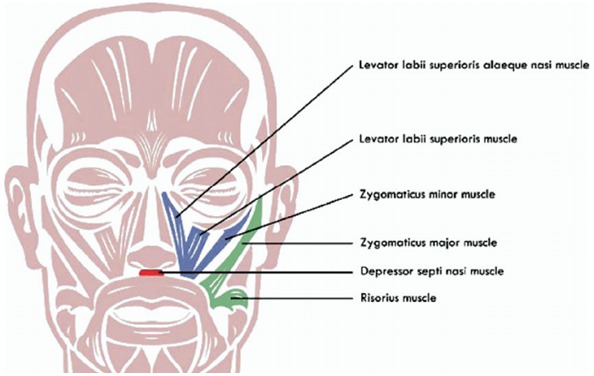 Figure 4: Musculature of the face: Pinpointing sites for injection.