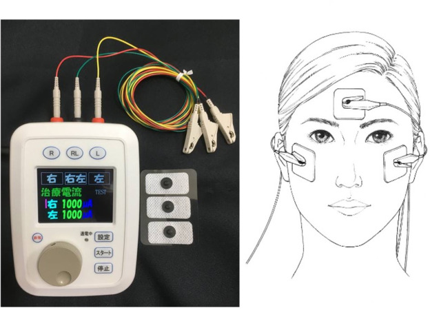 Figure 2