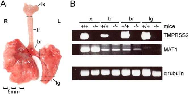 FIG 1