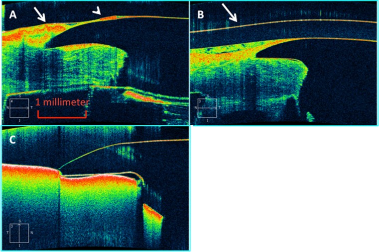 Fig. 4