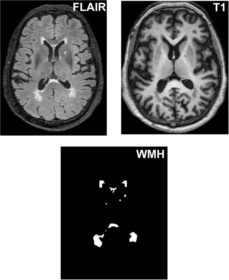 FIGURE 1