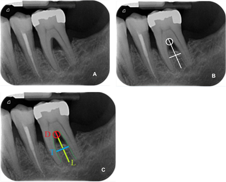 Fig. 2