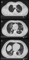 Fig. 2