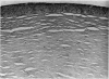 92