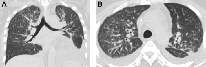 Fig. 5