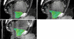 Fig. 11