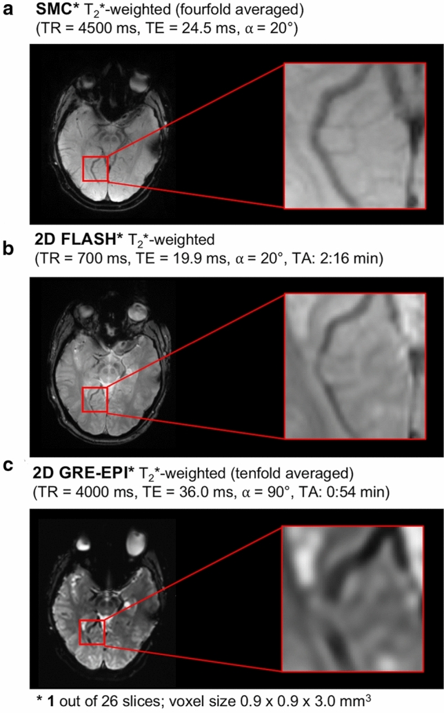 Fig. 11