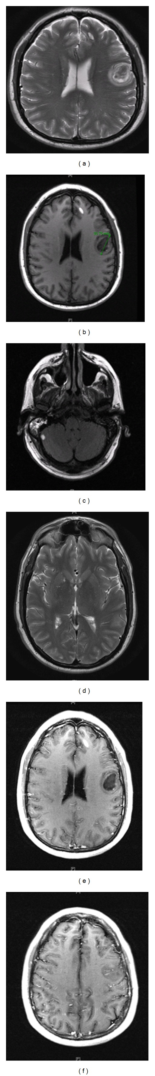 Figure 2