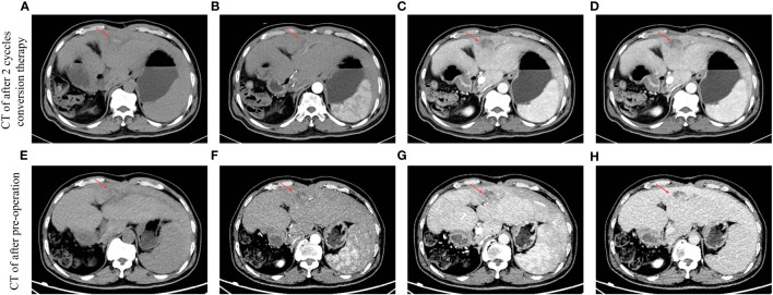 Figure 3