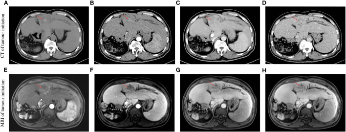 Figure 1