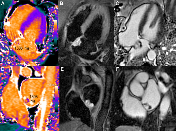 Figure 14