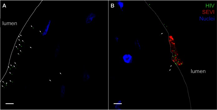 FIG 2