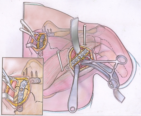 Fig. 2