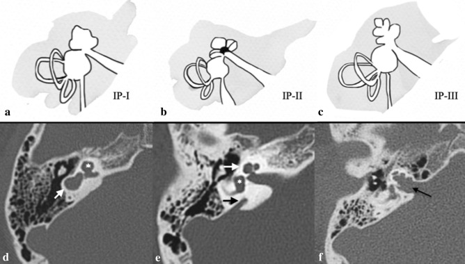 Fig. 9