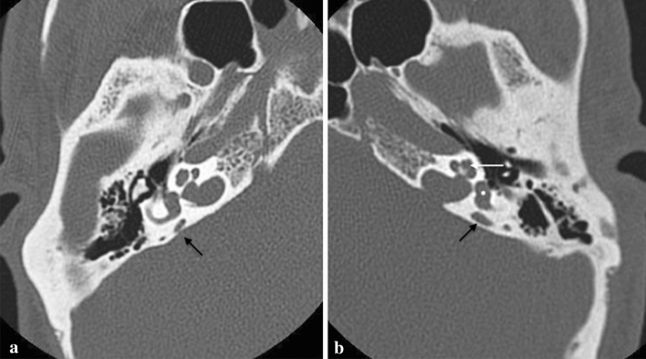 Fig. 11