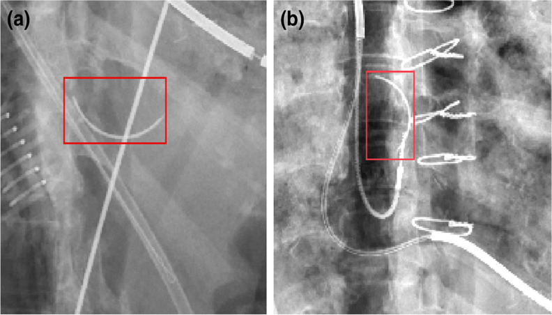 Fig. 3