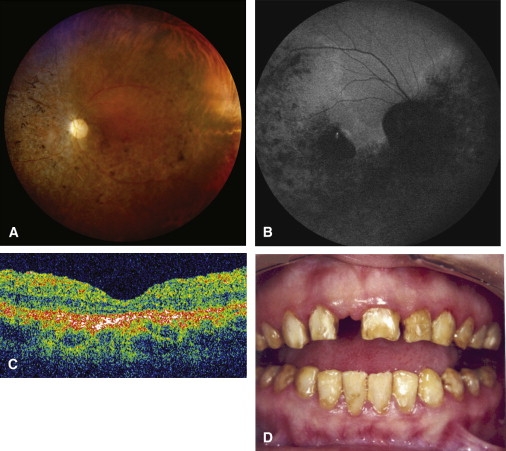 Figure 2