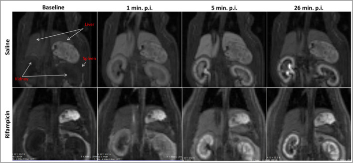 Fig. 1