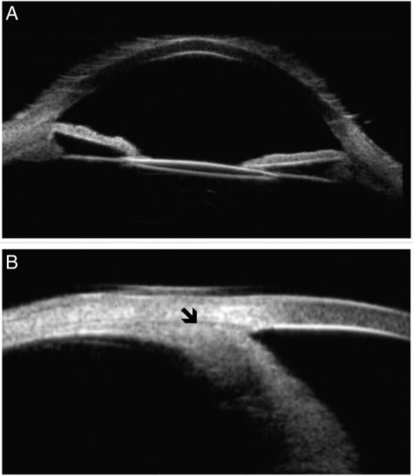 Figure 6