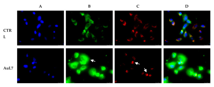 Figure 11