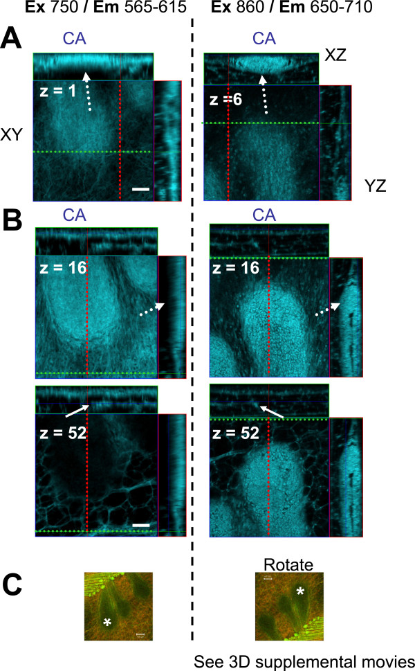 Figure 11