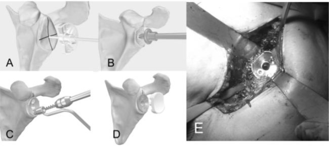 
Fig. 18
