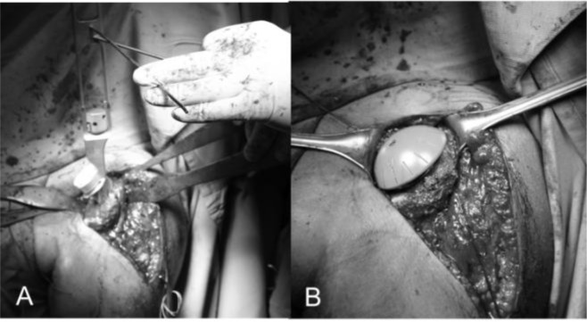 
Fig. 14
