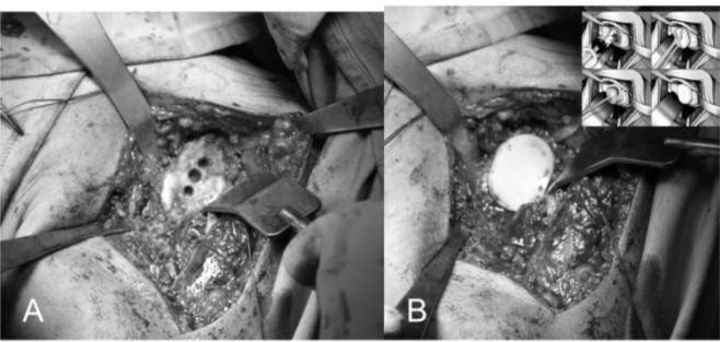 Fig. 17