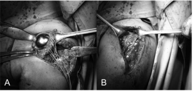 
Fig. 20
