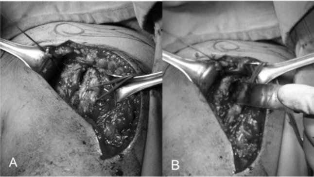 
Fig. 11
