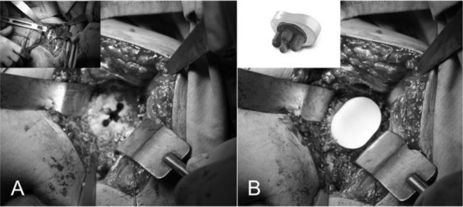 
Fig. 19
