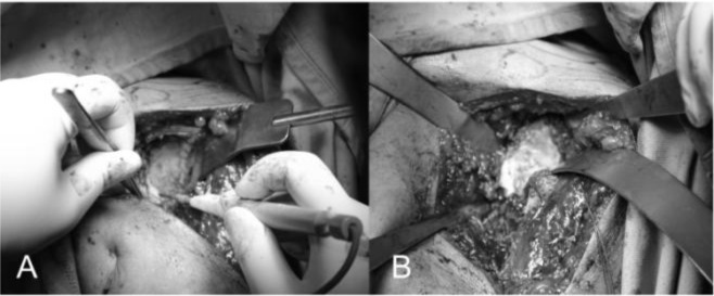 
Fig. 15A–B:
