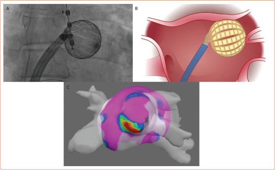 Figure 4: