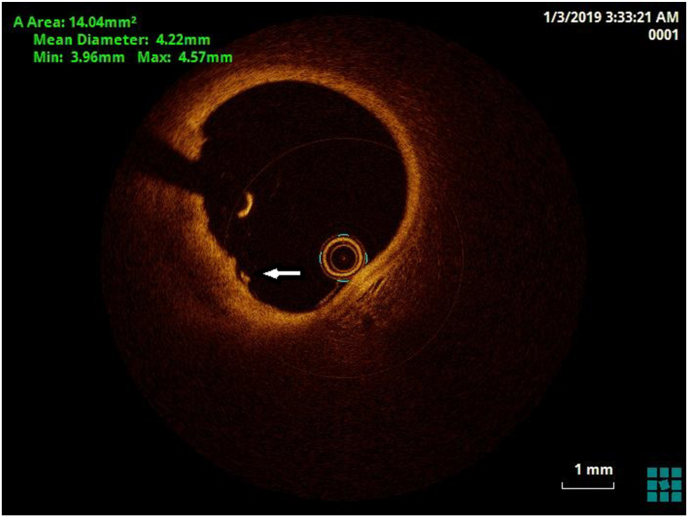 Fig. 2