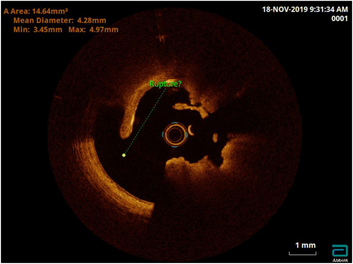 Fig. 1