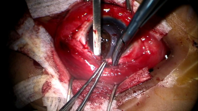 Video 2.