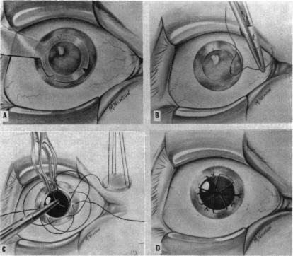 FIGURE 17.