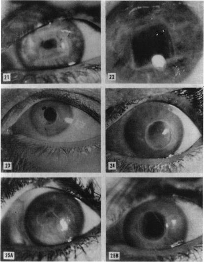 FIGURE 21, 22, 23, 24, 25