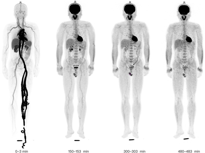 Fig. 1