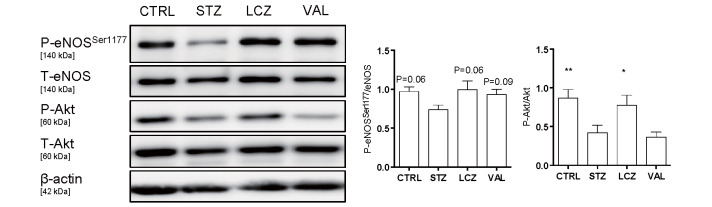 
Fig.2. LCZ696 administration restored eNOSSer1177 phosphorylation in diabetic mice
