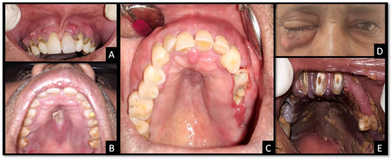 Fig. 1