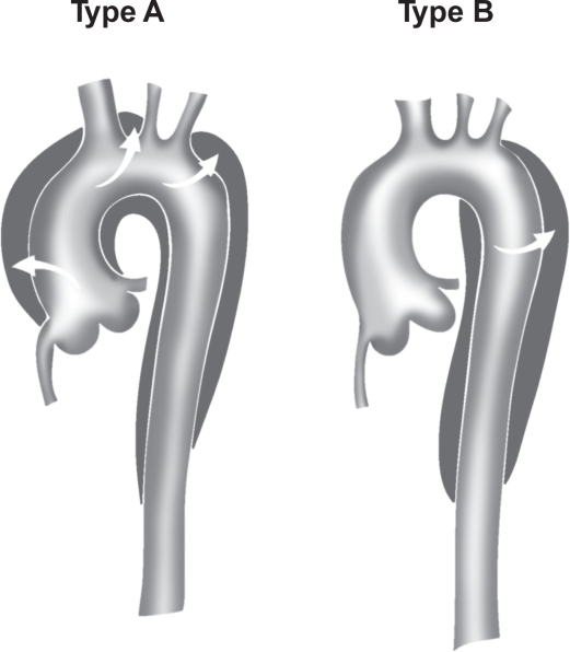 Figure 3B